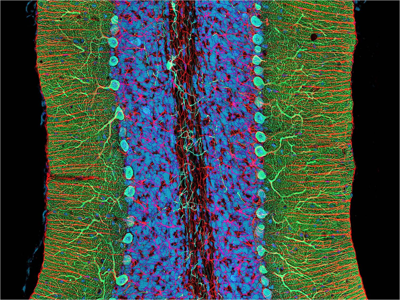 Illustration for article titled The Astounding And Horrific World As Seen Under A Microscope